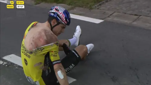 Van Aert breaks collarbone, ribs in Flanders fall