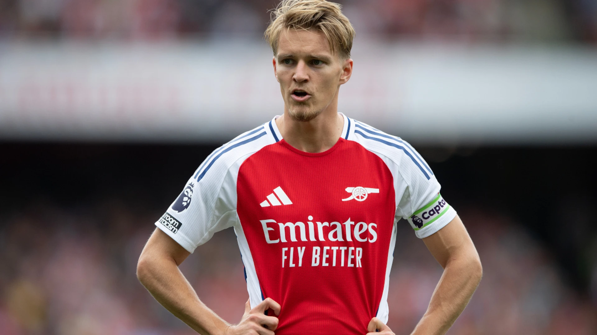 Odegaard injury has forced Arsenal to be 'different', says Arteta