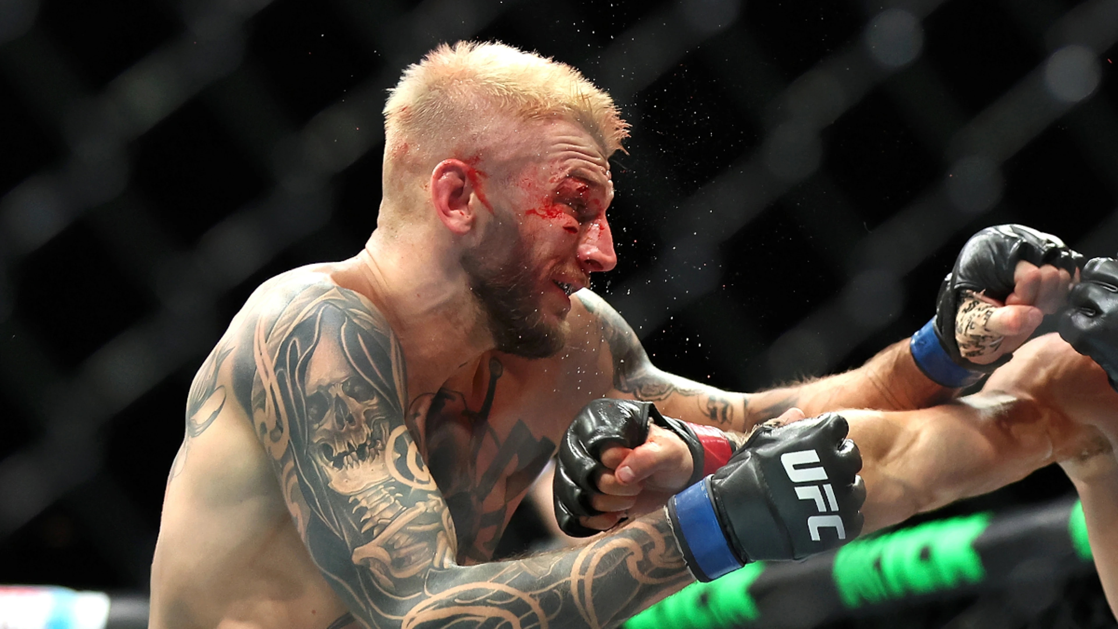 Hooker undergoes hand surgery after UFC 313 withdrawal