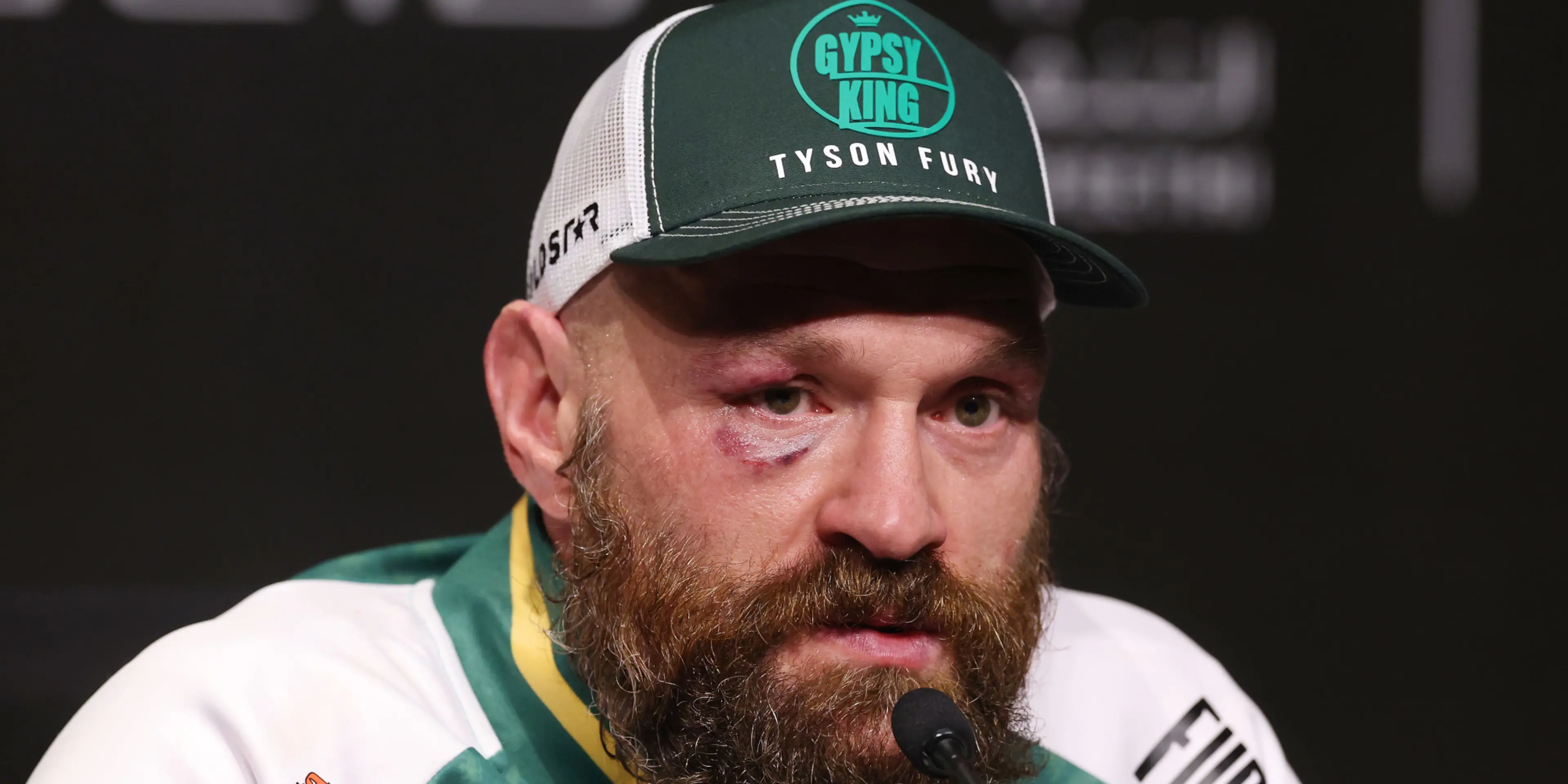Fury confirms comeback fight against Makhmudov in April