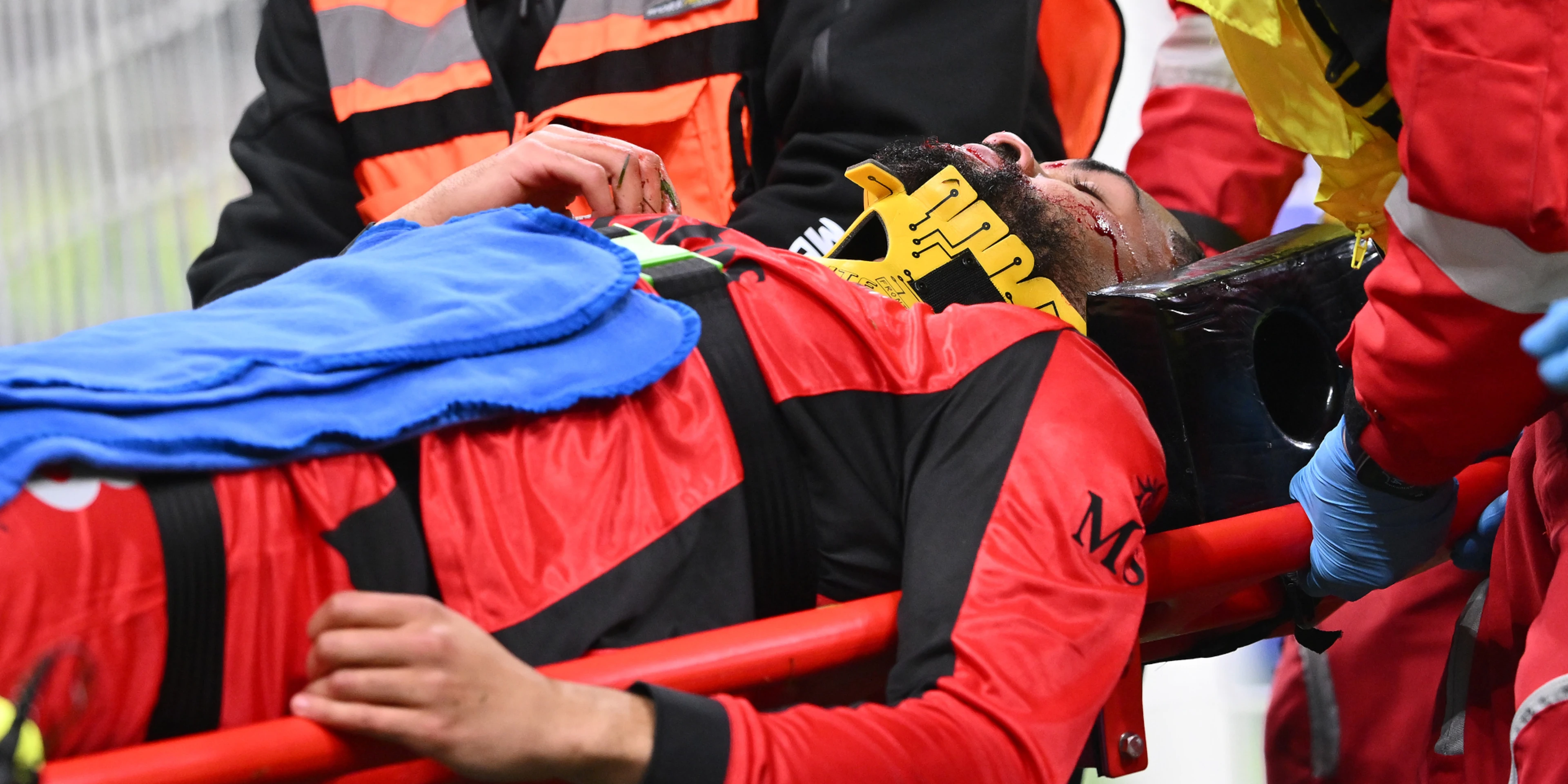 AC Milan's Loftus-Cheek to undergo surgery after jaw fracture