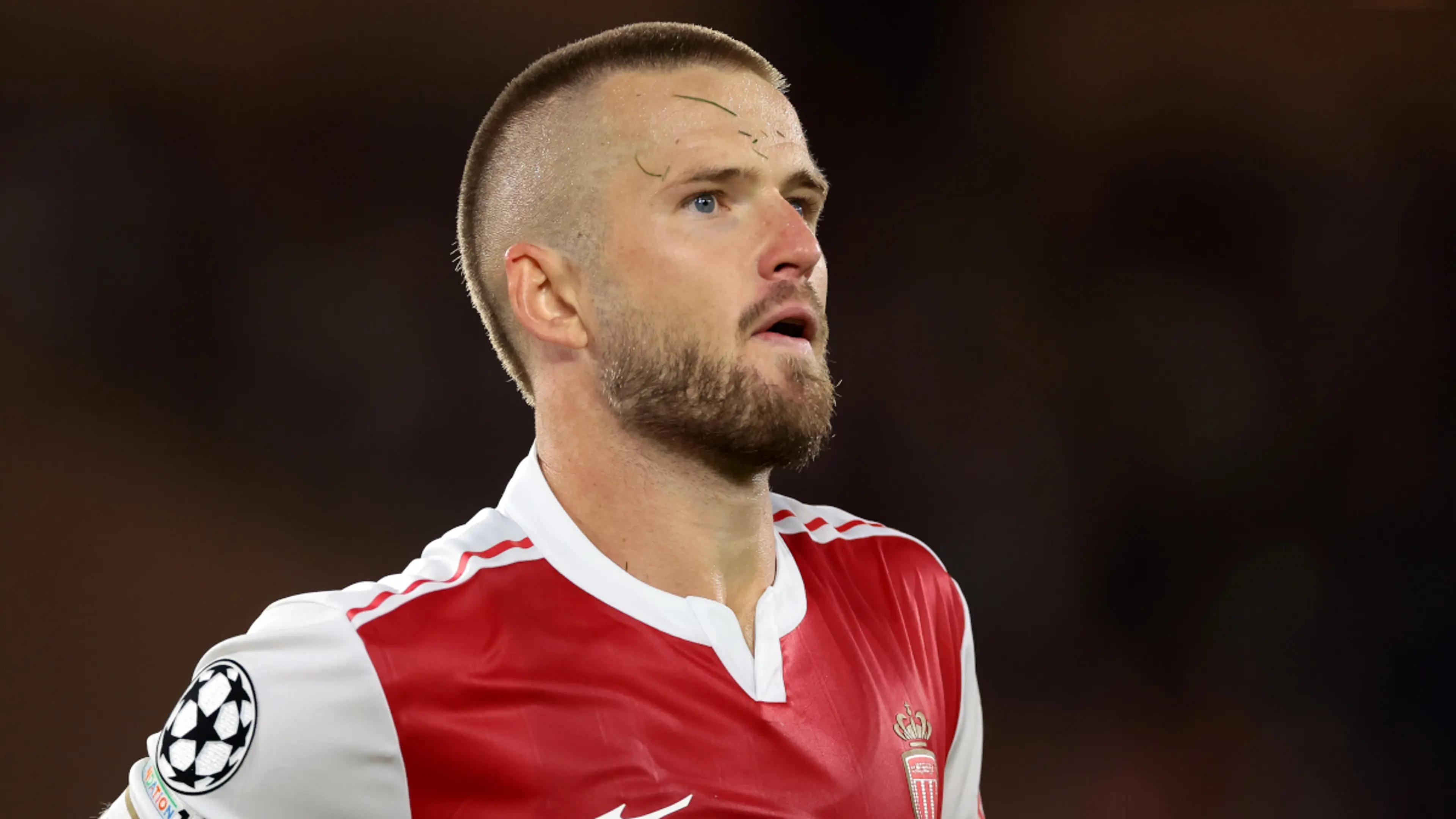 Monaco's Dier in doubt for Tottenham rematch