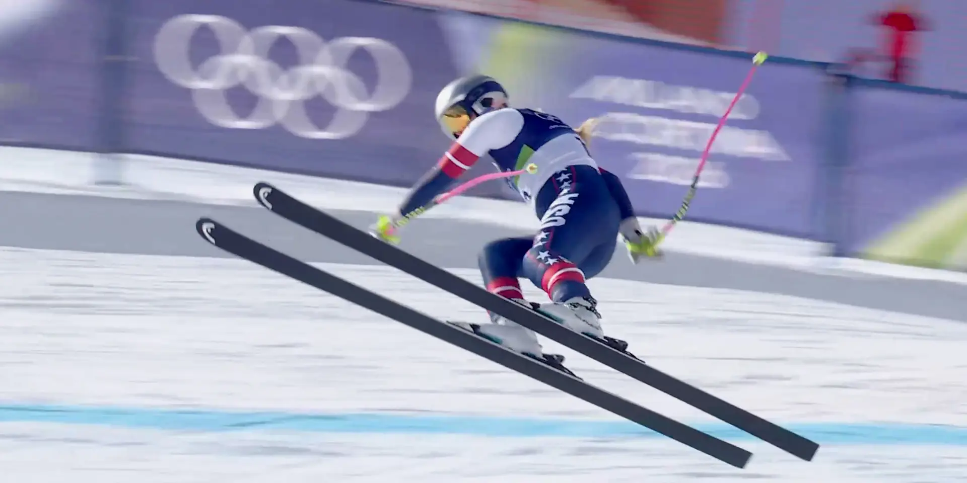 Vonn needs surgery on fracture after brutal end to Olympic dream