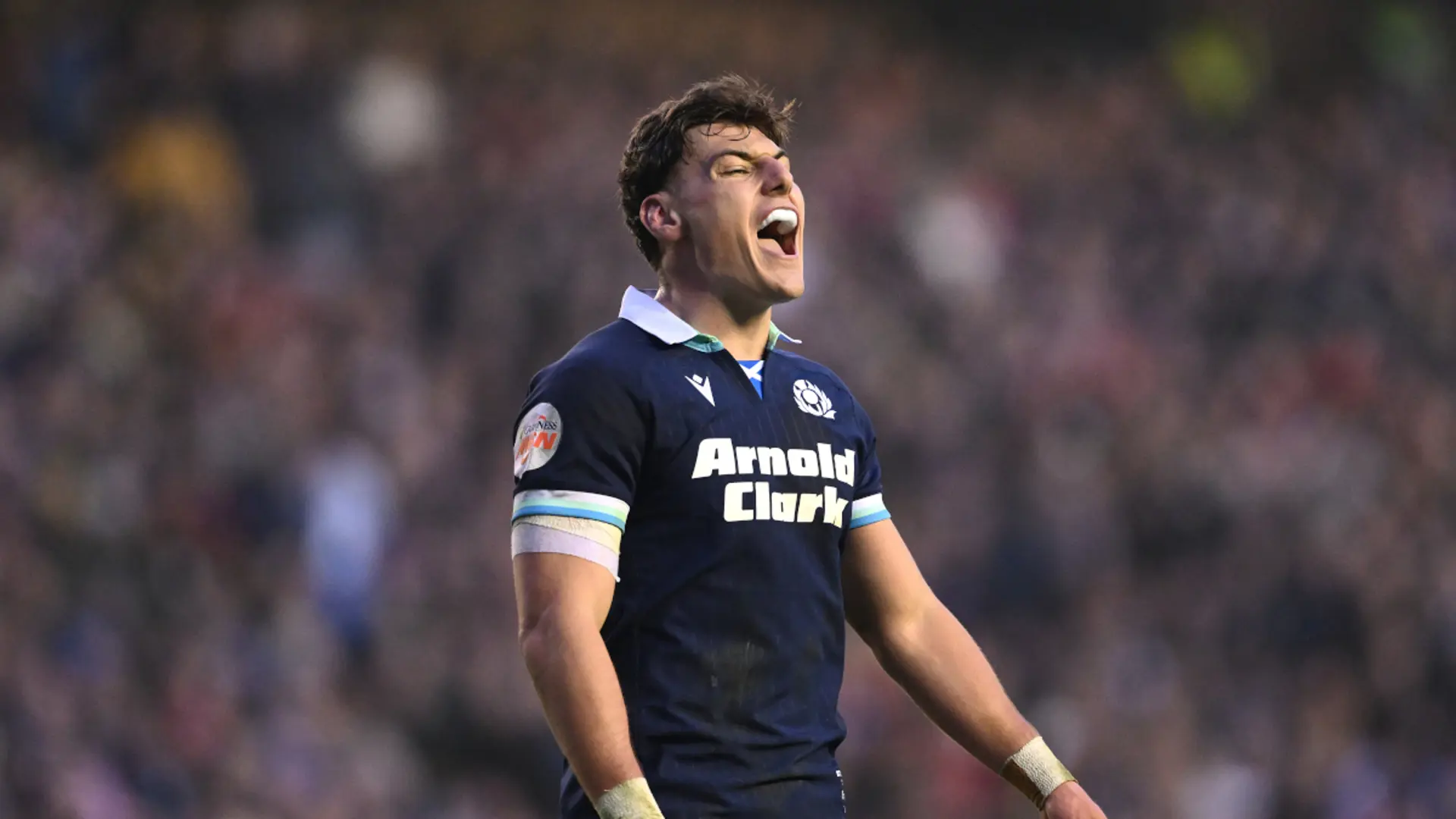 Scotland lose Jordan and Ritchie to injury